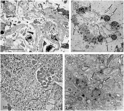 Global patterns in symbiont selection and transmission strategies in sponges